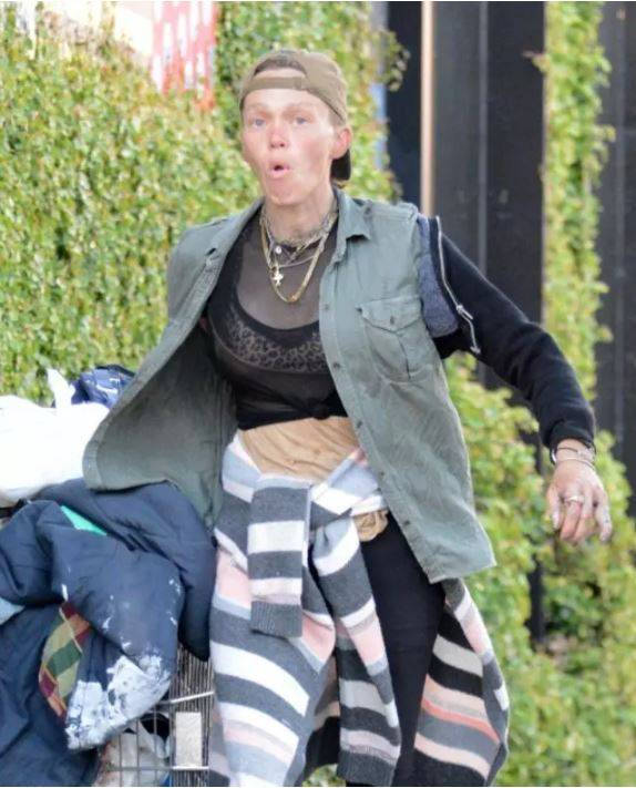 Ünlü model Loni Willison ön dişleri dökük yine çöp toplarken görüntülendi - Resim: 10